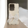 Vivo Y200 Girlish Back Cover/Fancy Bow Back Cover